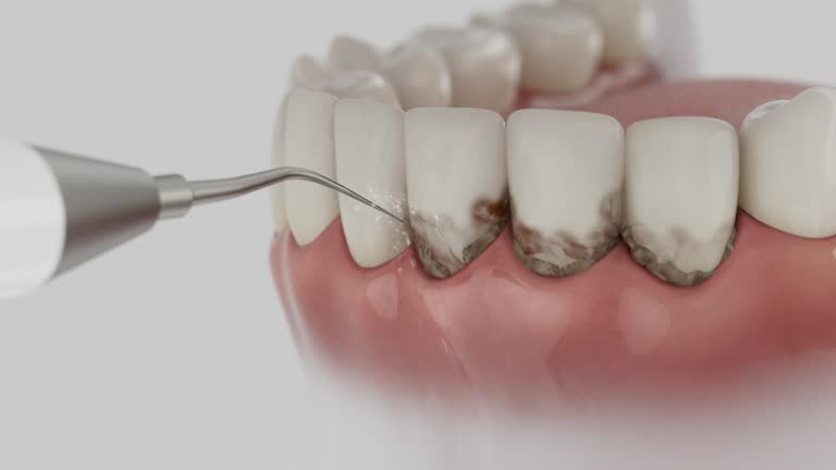 Reliable Dental contractor in Far Hills, NJ by Smile Center Dentistry